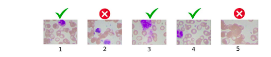 使用简单方法在图像中检测血细胞