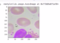 使用简单方法在图像中检测血细胞